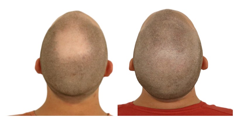 /foren/transplant/index.php/fa/39195/0/