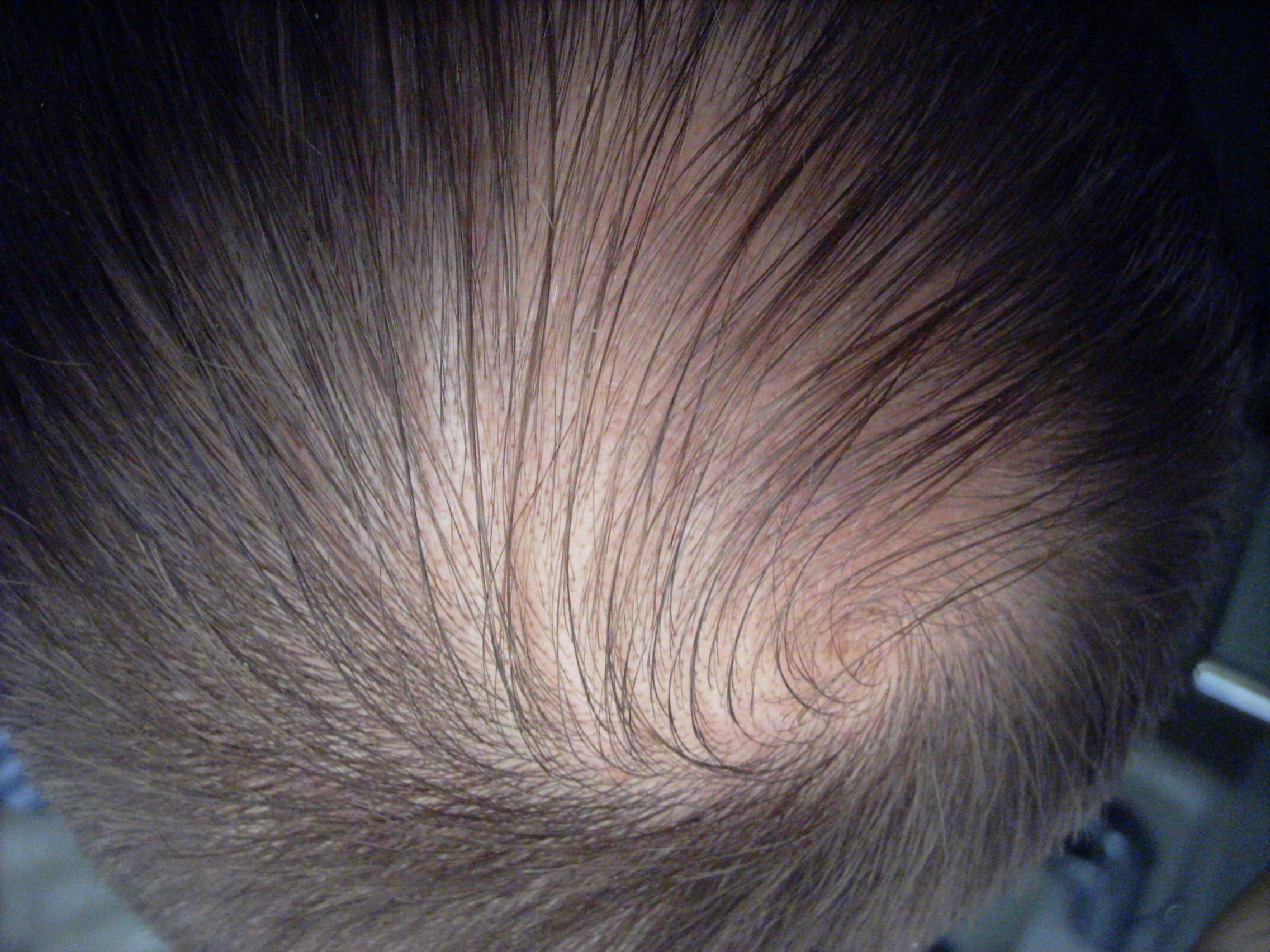 index.php/fa/3927/0/