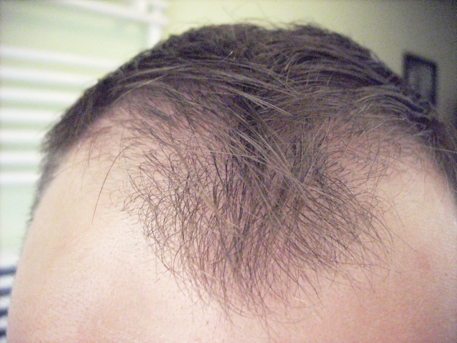 index.php/fa/3928/0/