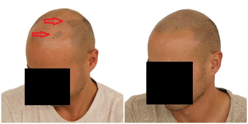 /foren/transplant/index.php/fa/39366/0/