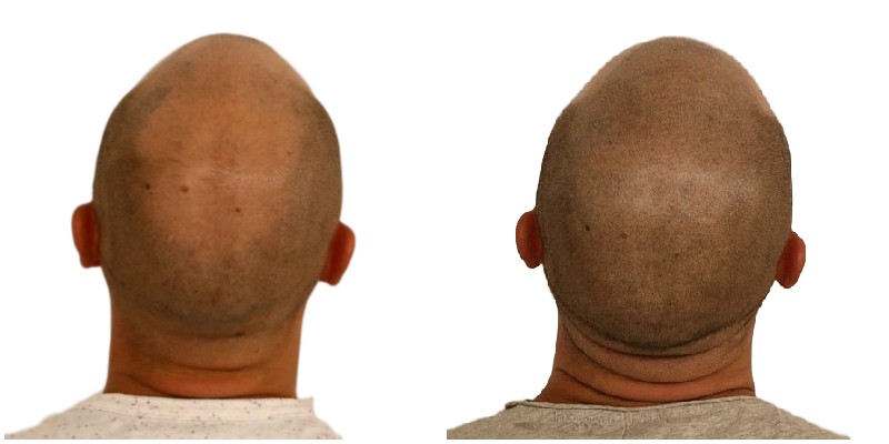 /foren/transplant/index.php/fa/39368/0/