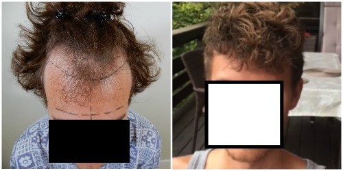 /foren/transplant/index.php/fa/39386/0/