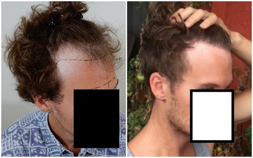 /foren/transplant/index.php/fa/39387/0/