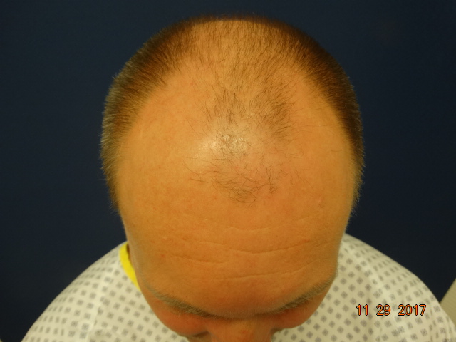 /foren/transplant/index.php/fa/39449/0/