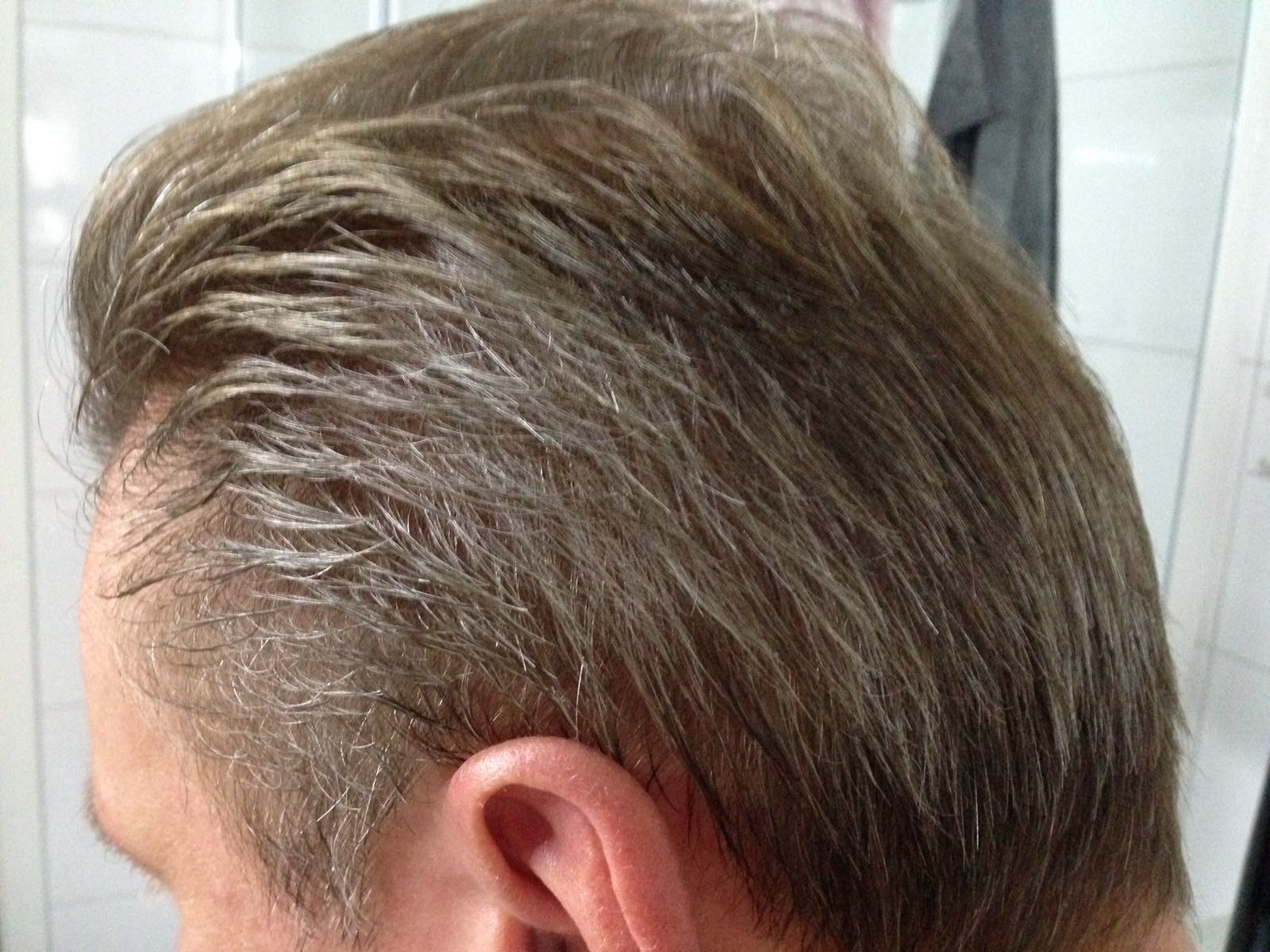 /foren/transplant/index.php/fa/39455/0/