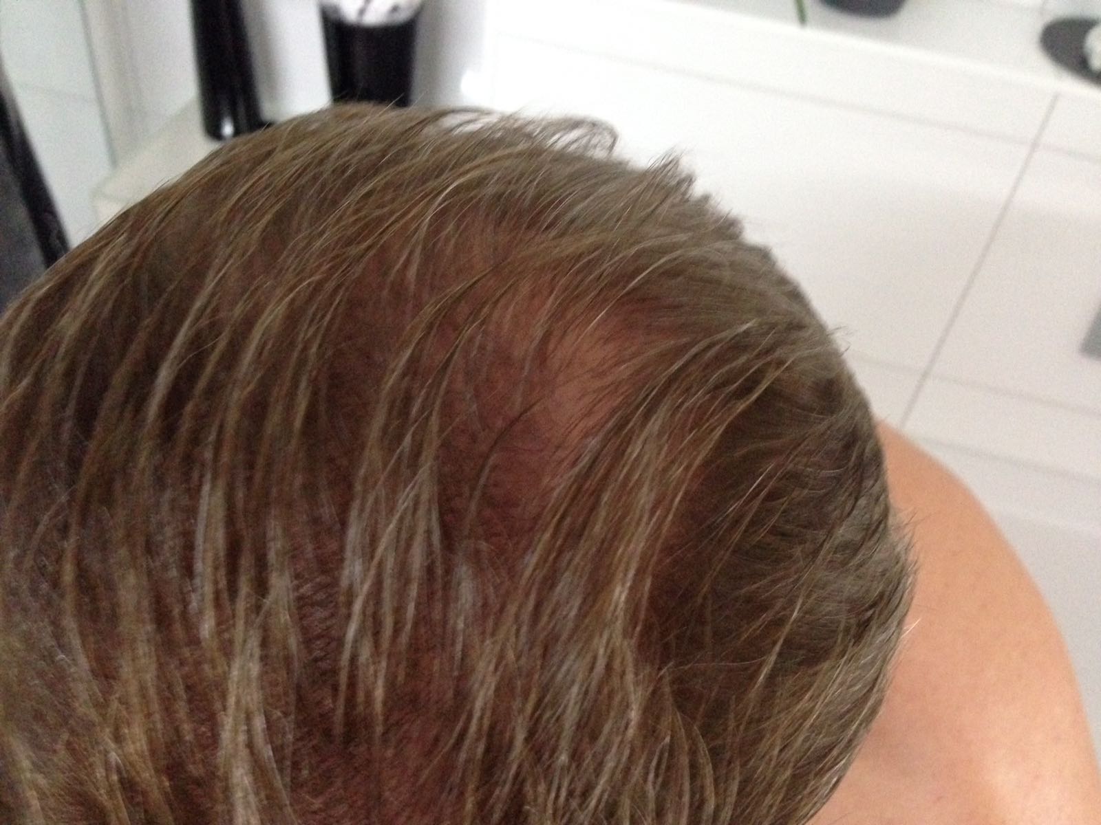 /foren/transplant/index.php/fa/39482/0/