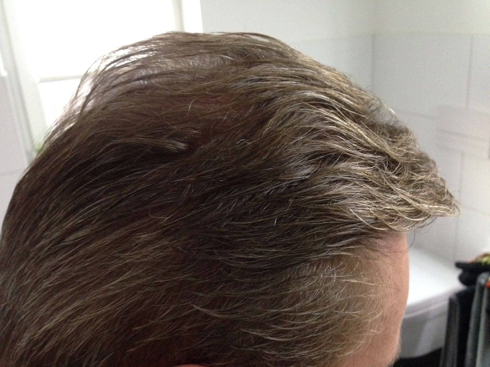 /foren/transplant/index.php/fa/39483/0/