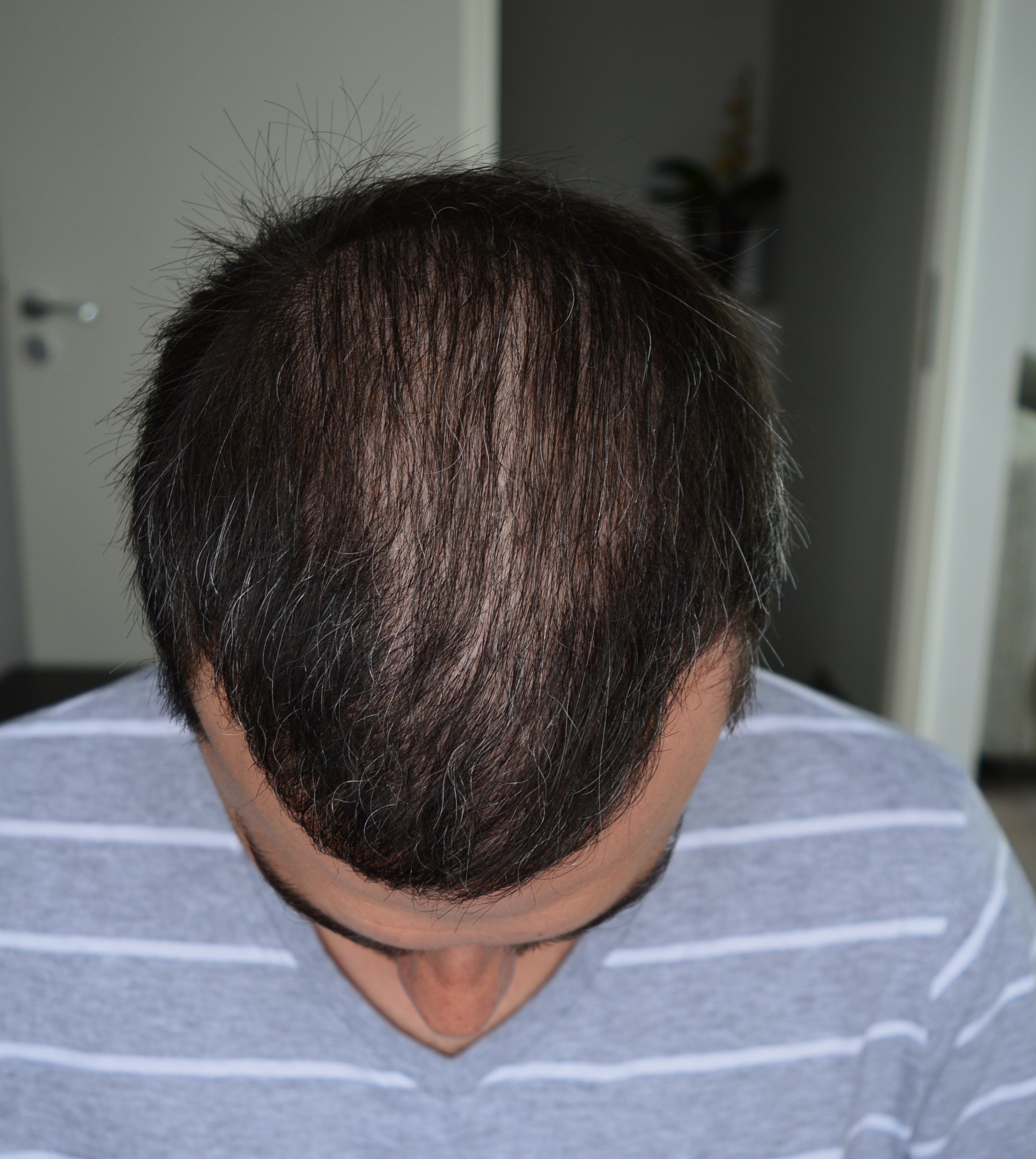 /foren/transplant/index.php/fa/39512/0/