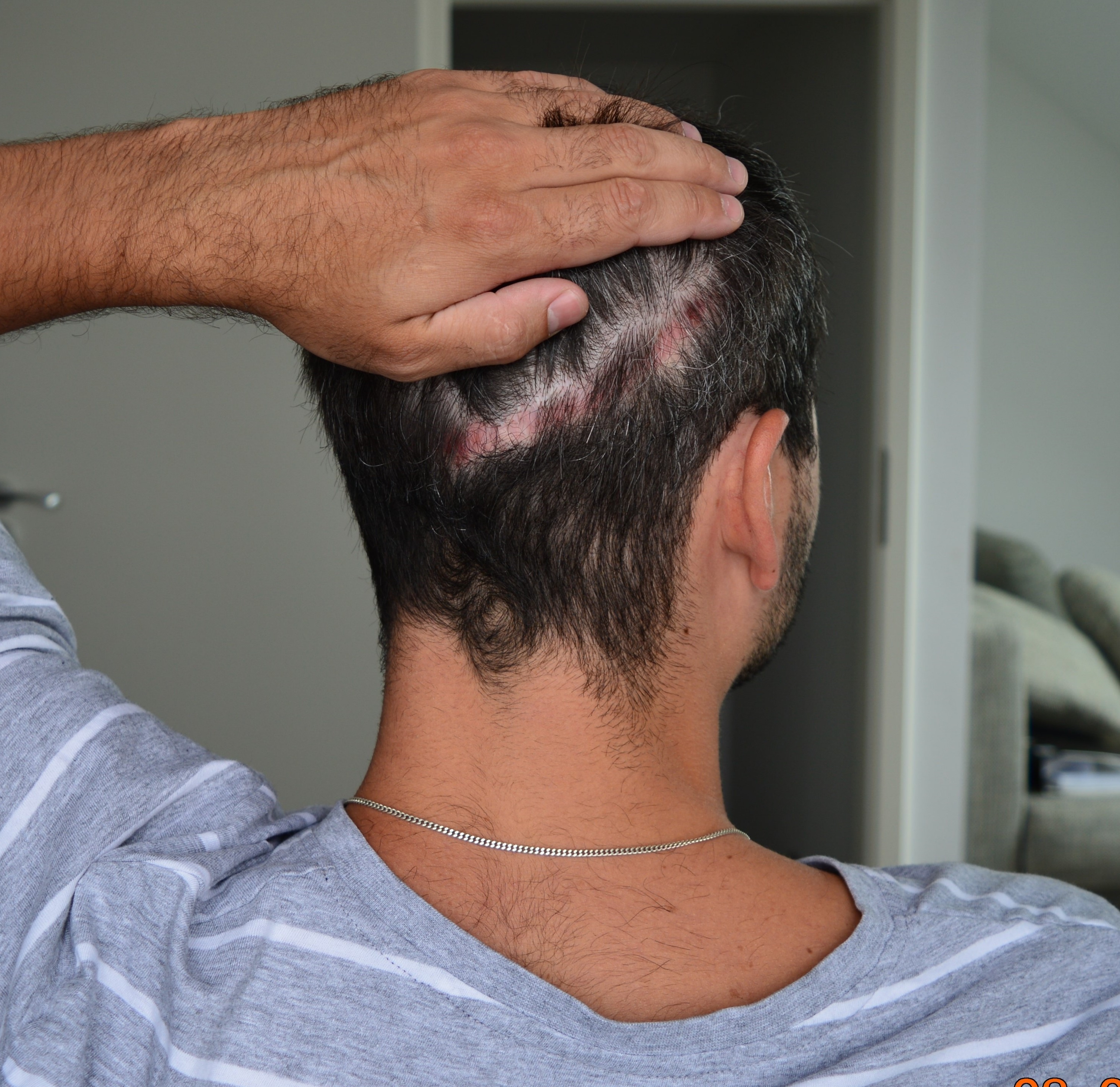 /foren/transplant/index.php/fa/39516/0/