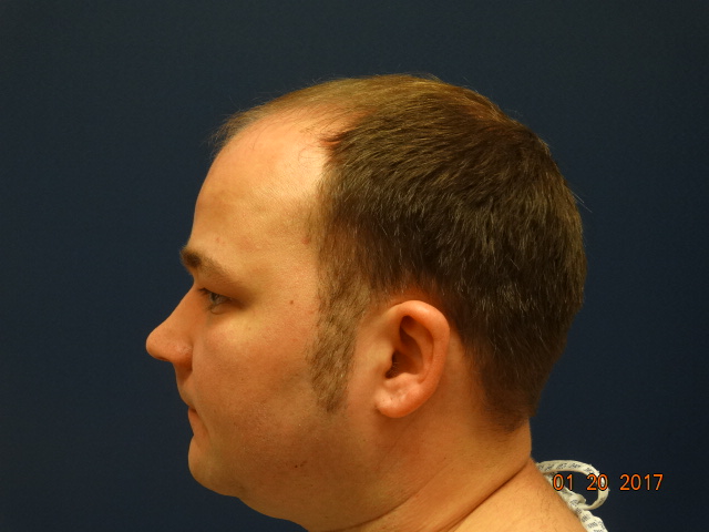 /foren/transplant/index.php/fa/39539/0/