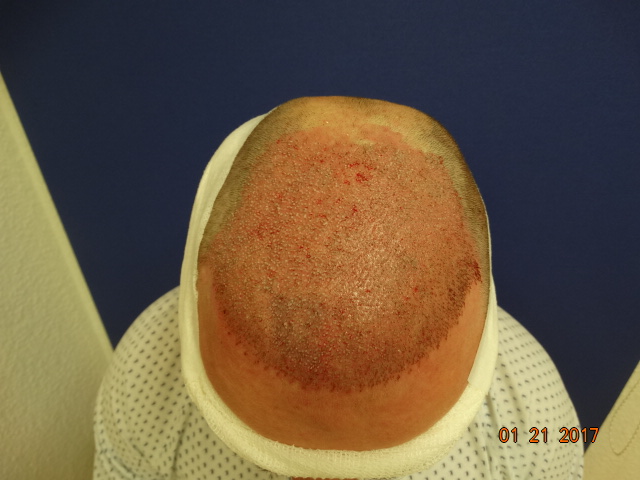 /foren/transplant/index.php/fa/39542/0/