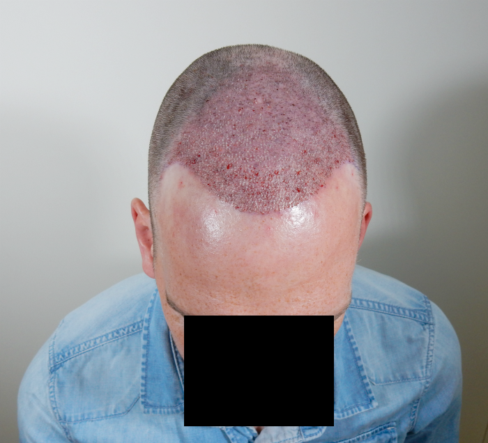 /foren/transplant/index.php/fa/39570/0/