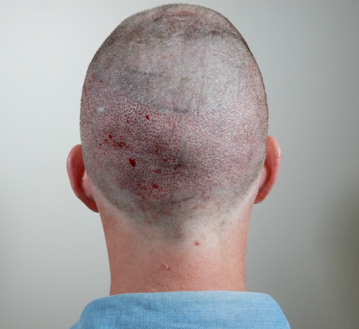 /foren/transplant/index.php/fa/39571/0/