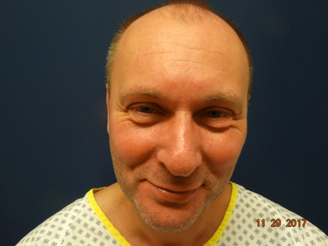 /foren/transplant/index.php/fa/39583/0/