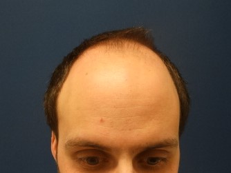 /foren/transplant/index.php/fa/39587/0/