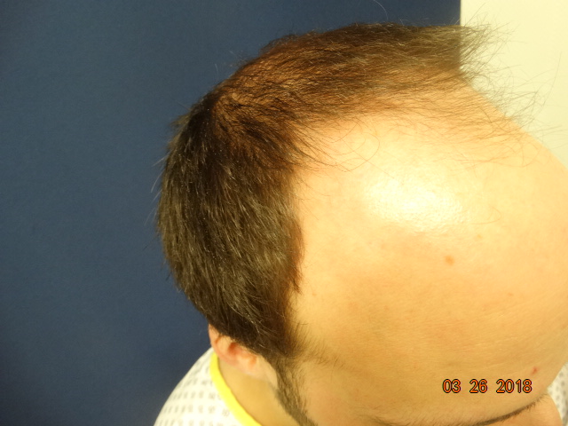 /foren/transplant/index.php/fa/39589/0/