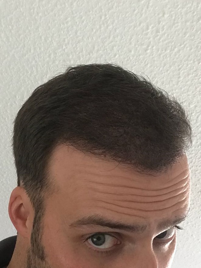 /foren/transplant/index.php/fa/39590/0/