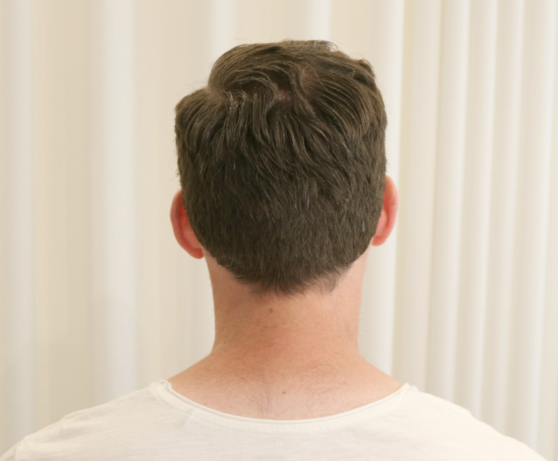 /foren/transplant/index.php/fa/39633/0/