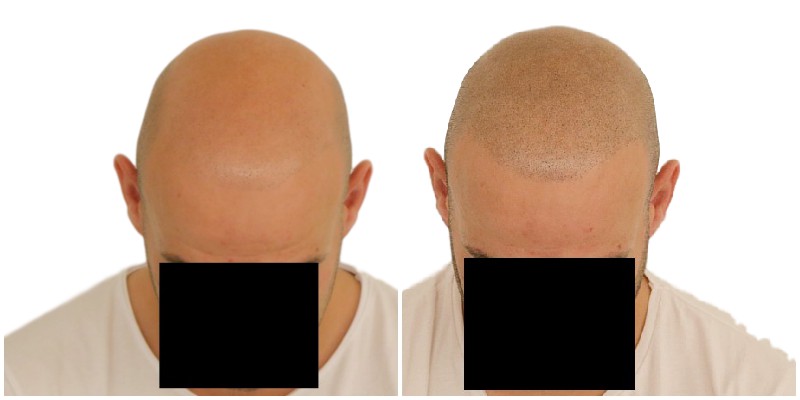 /foren/transplant/index.php/fa/39643/0/