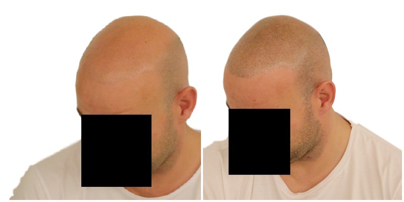 /foren/transplant/index.php/fa/39644/0/