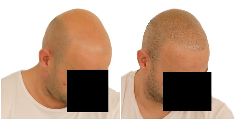 /foren/transplant/index.php/fa/39645/0/