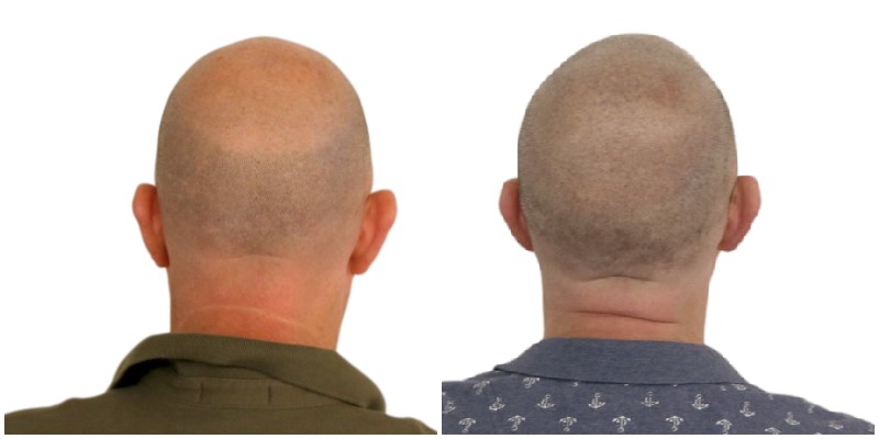 /foren/transplant/index.php/fa/39815/0/