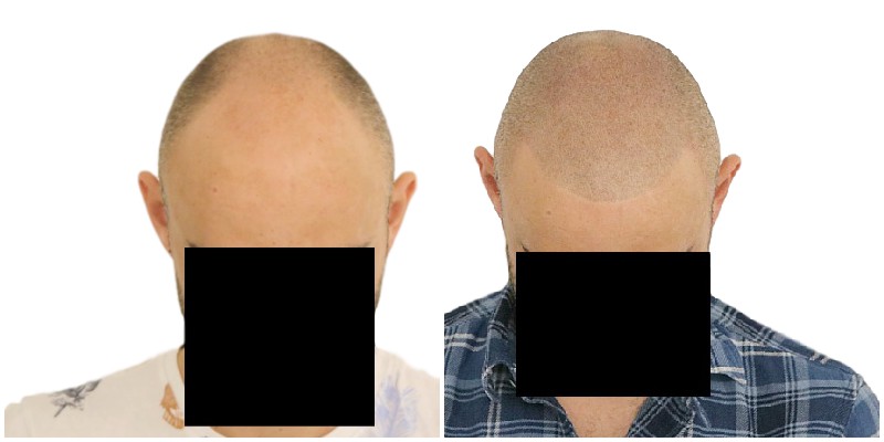 /foren/transplant/index.php/fa/40024/0/