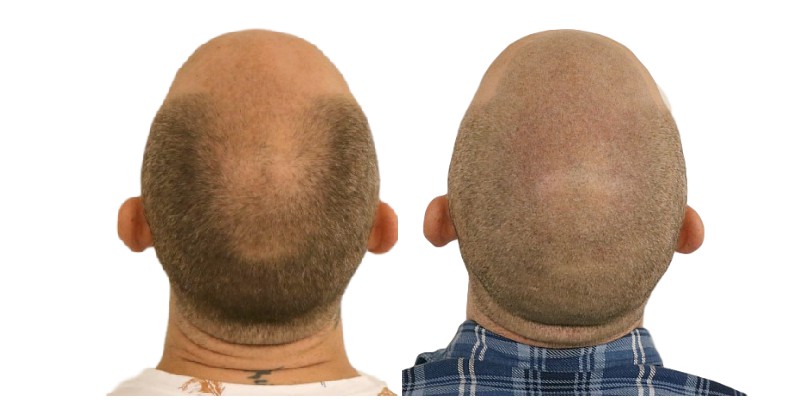 /foren/transplant/index.php/fa/40229/0/