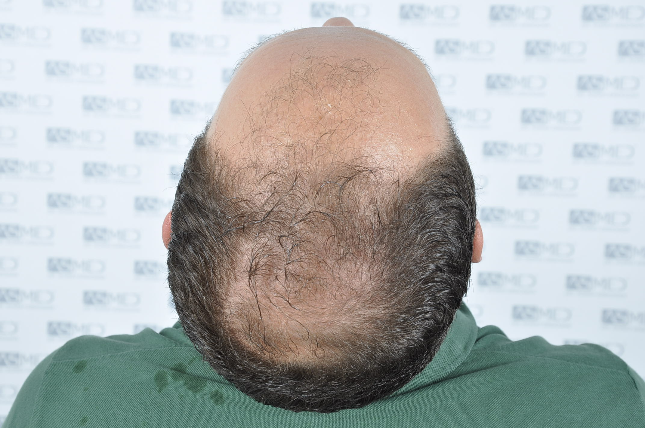 /foren/transplant/index.php/fa/40325/0/