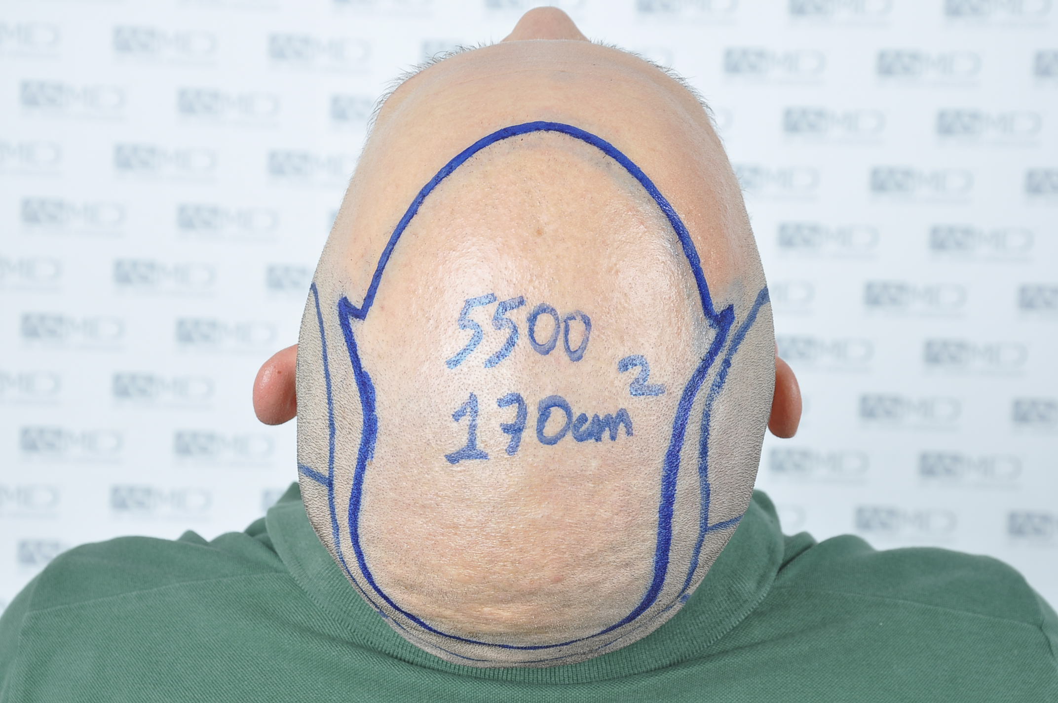 /foren/transplant/index.php/fa/40326/0/