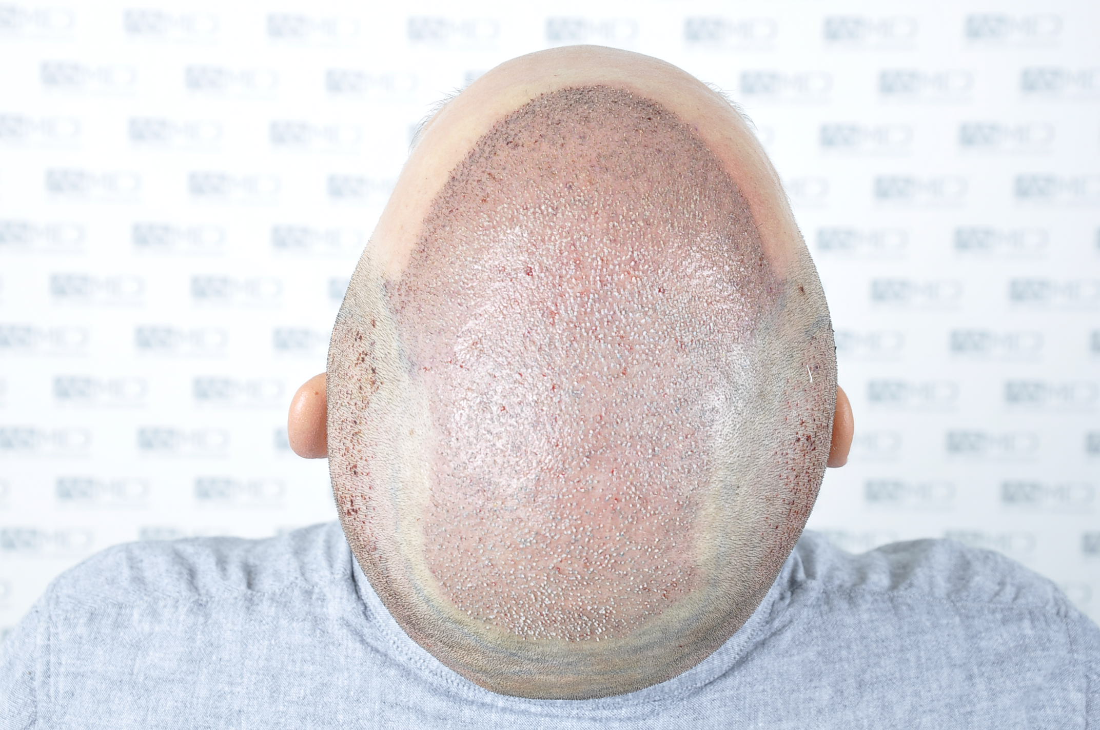 /foren/transplant/index.php/fa/40330/0/