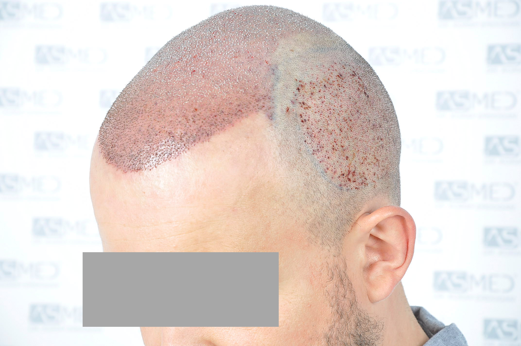 /foren/transplant/index.php/fa/40331/0/