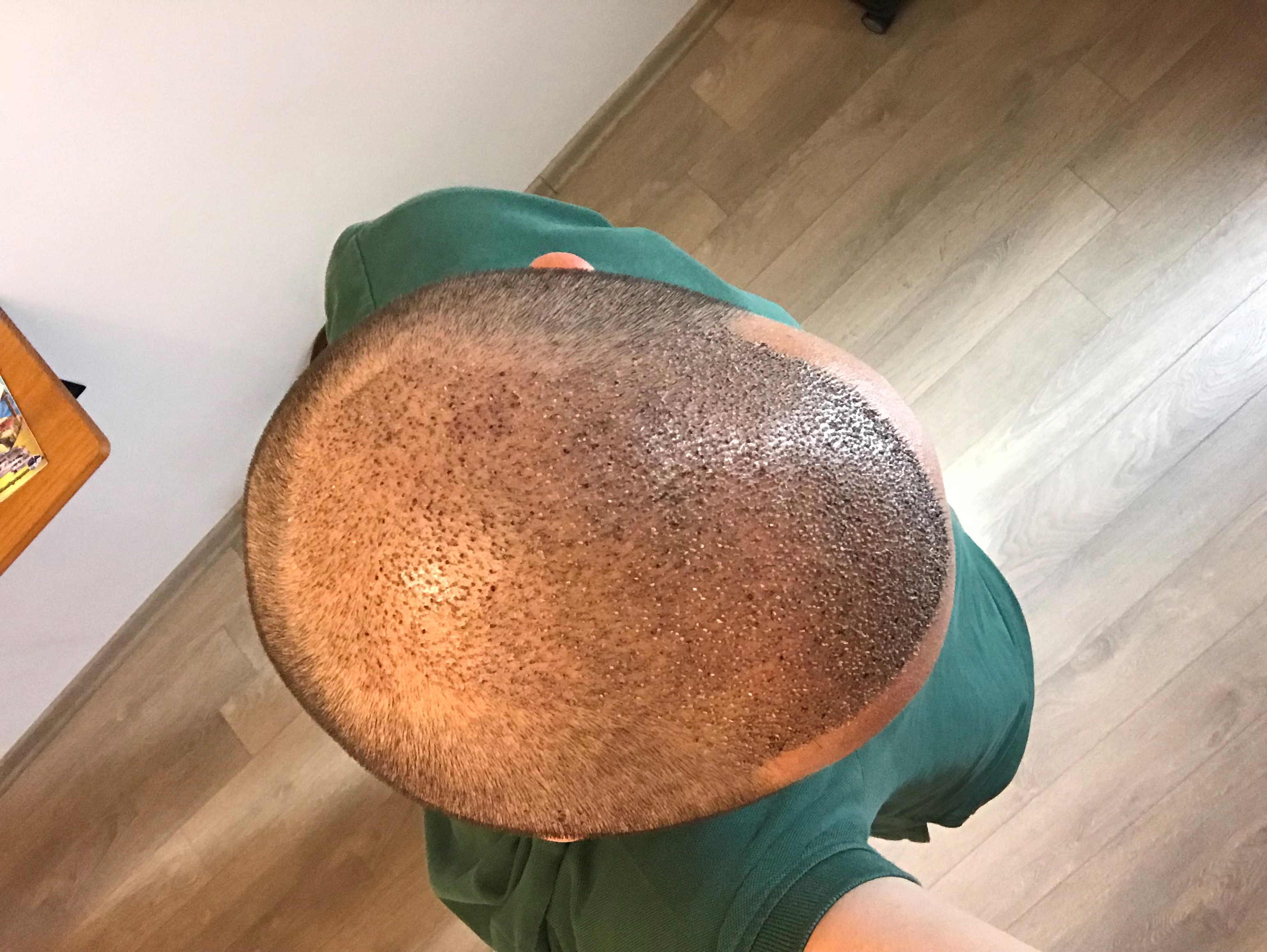 /foren/transplant/index.php/fa/40332/0/