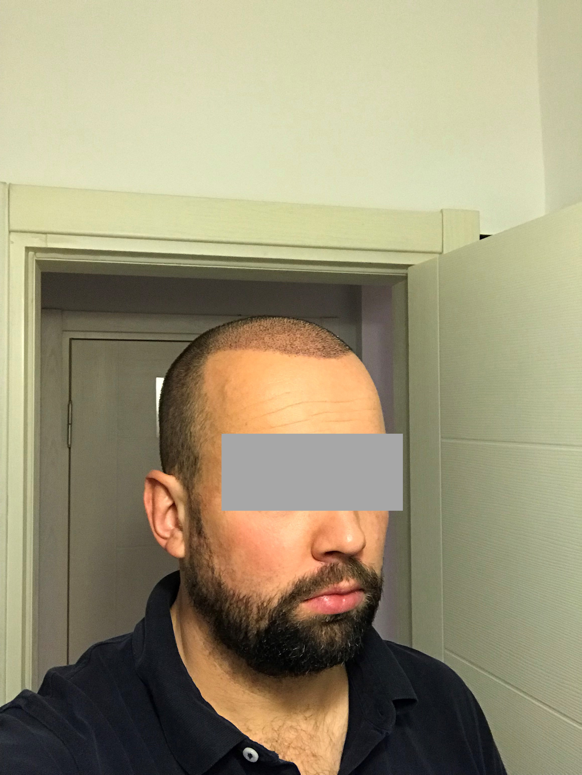 /foren/transplant/index.php/fa/40333/0/