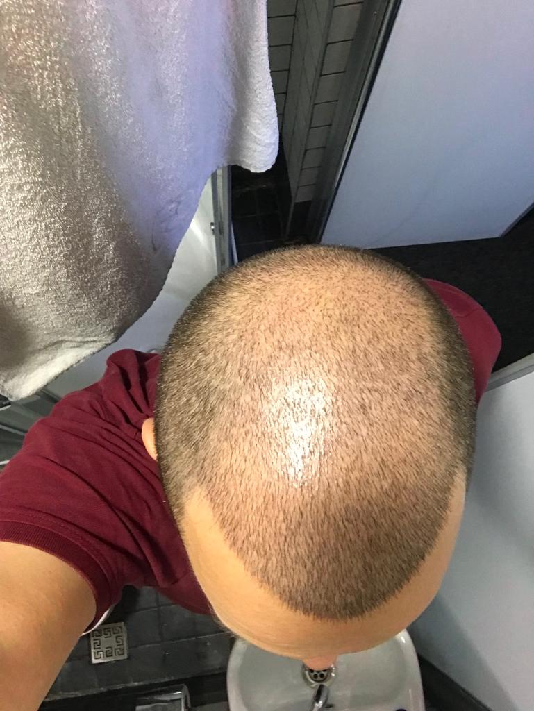 /foren/transplant/index.php/fa/40334/0/