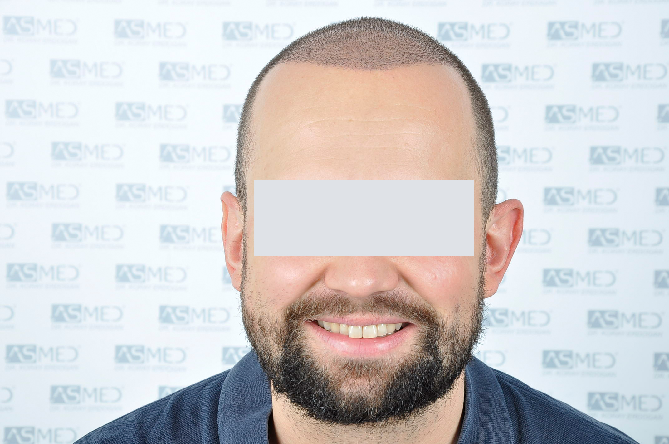 /foren/transplant/index.php/fa/40335/0/