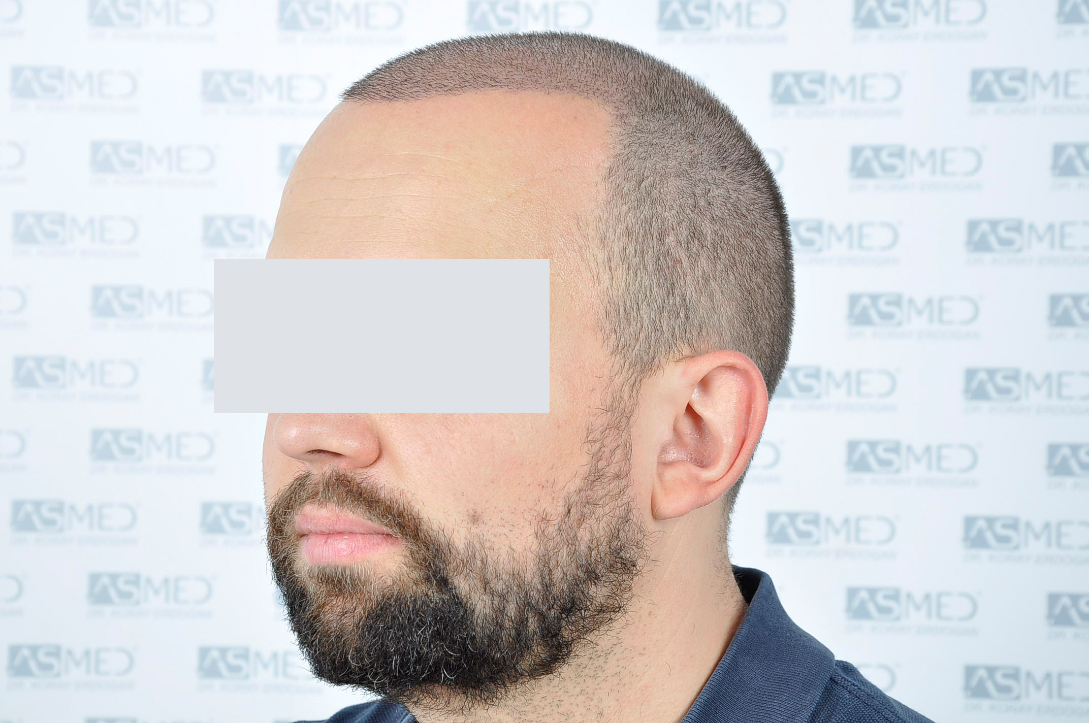 /foren/transplant/index.php/fa/40336/0/