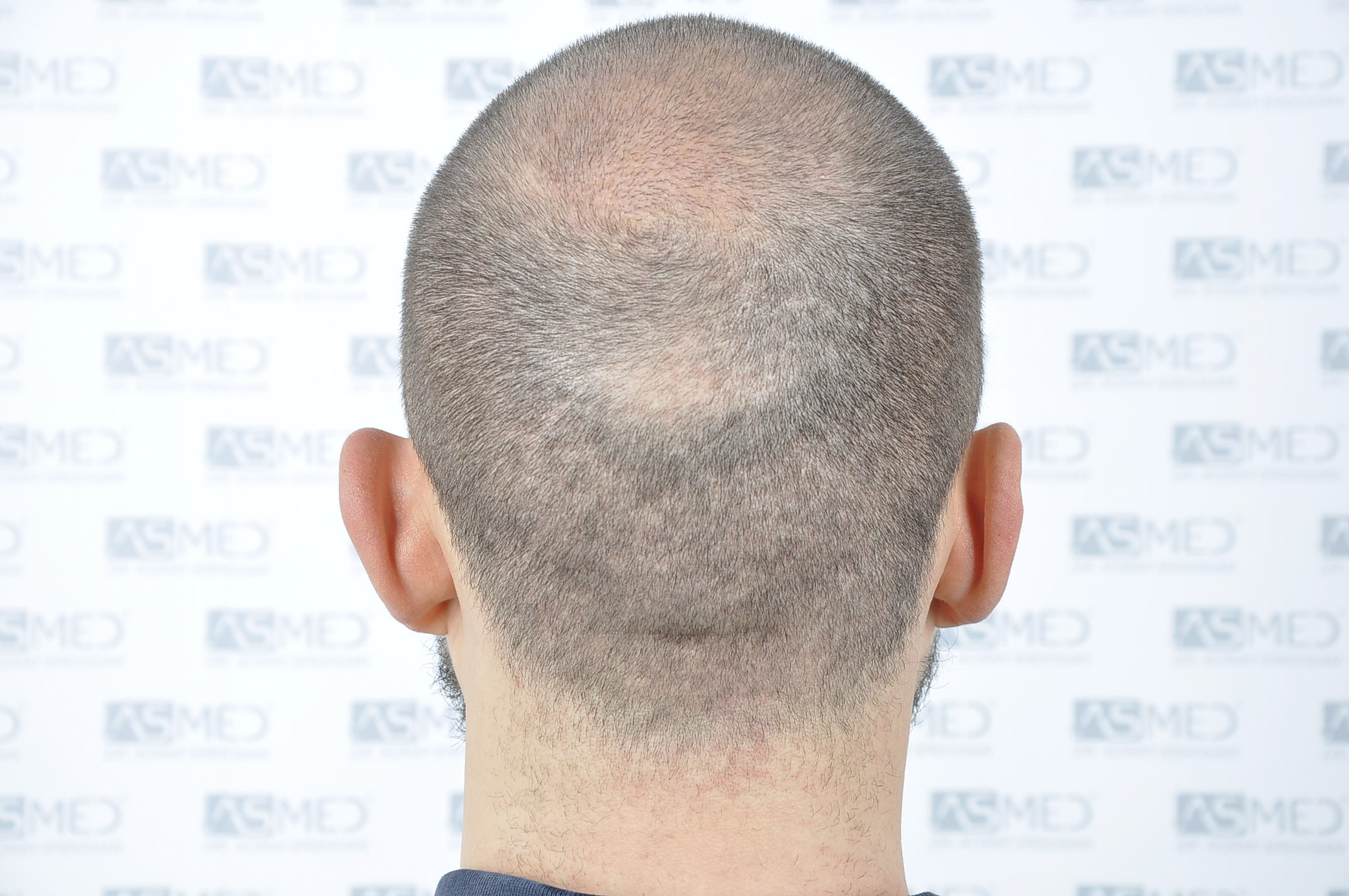 /foren/transplant/index.php/fa/40340/0/