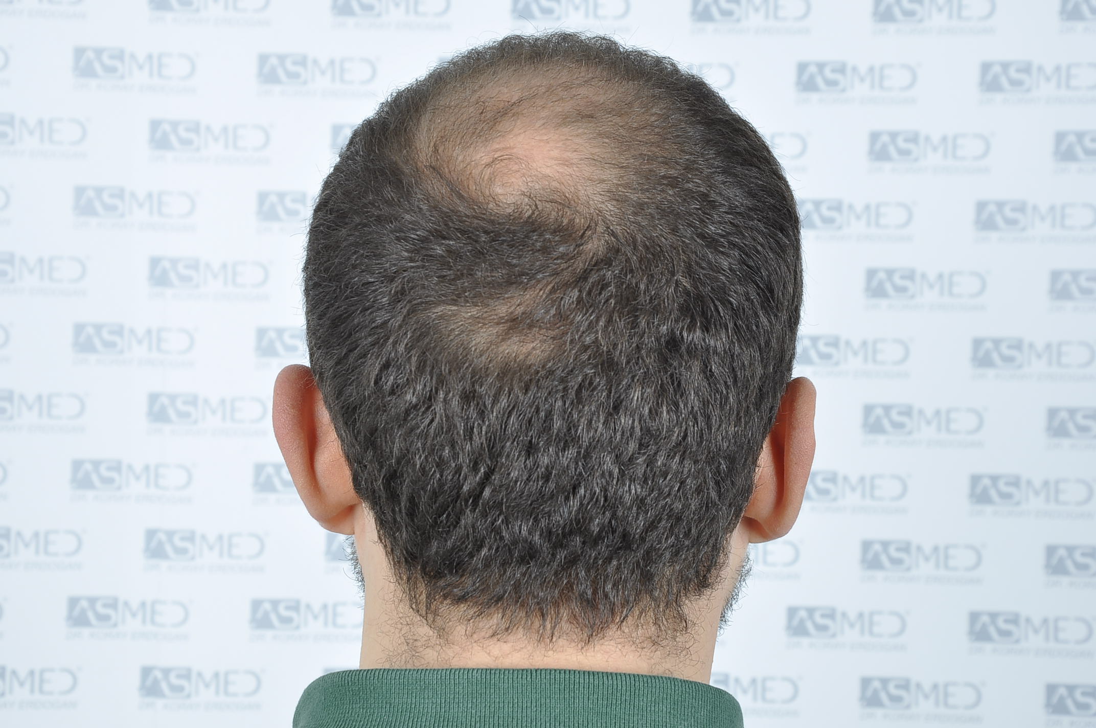 /foren/transplant/index.php/fa/40341/0/