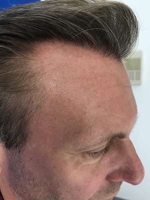 /foren/transplant/index.php/fa/40344/0/