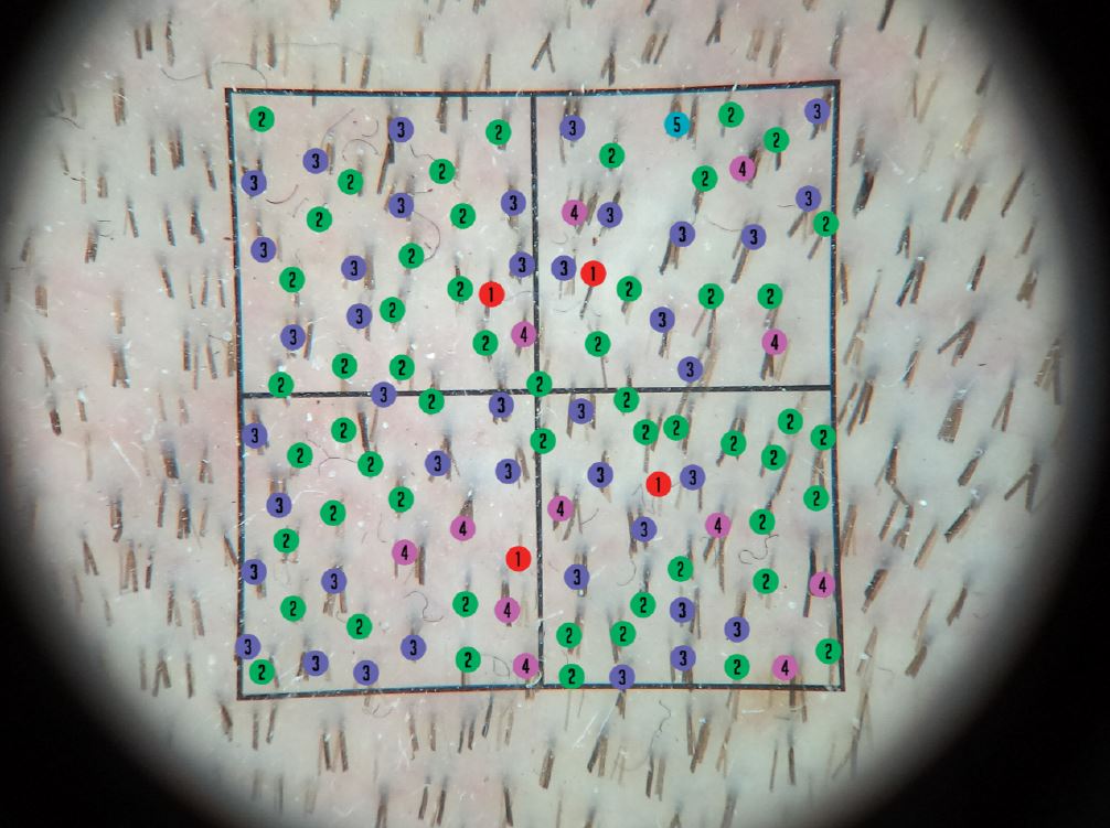 /foren/transplant/index.php/fa/40372/0/