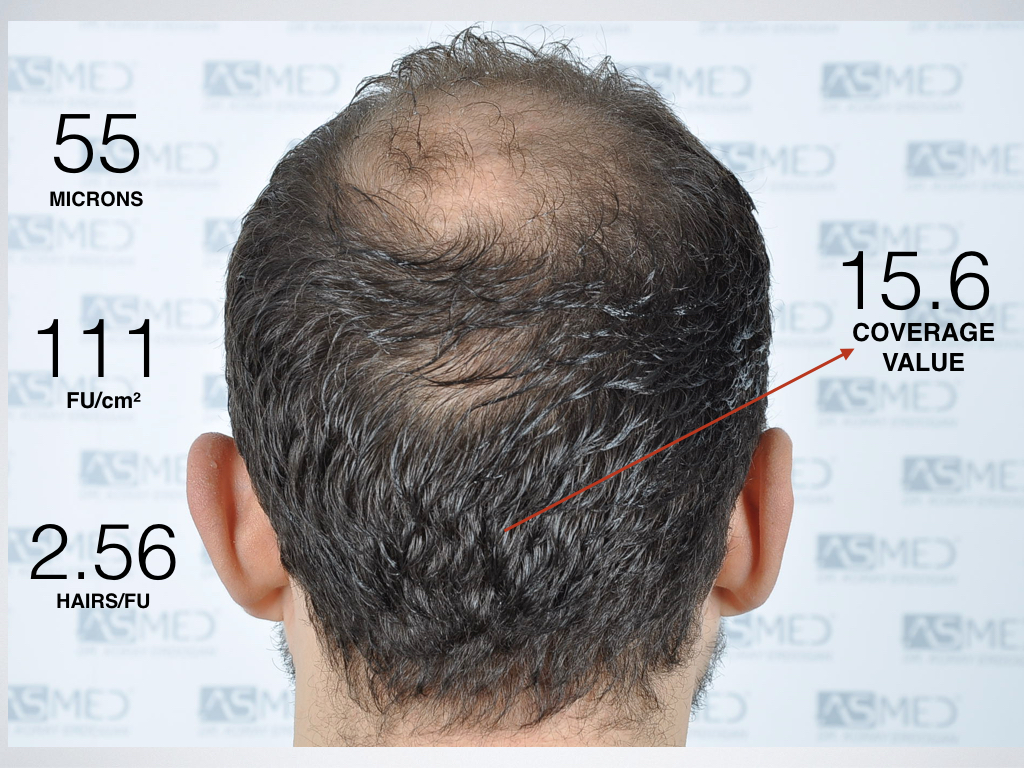 /foren/transplant/index.php/fa/40373/0/