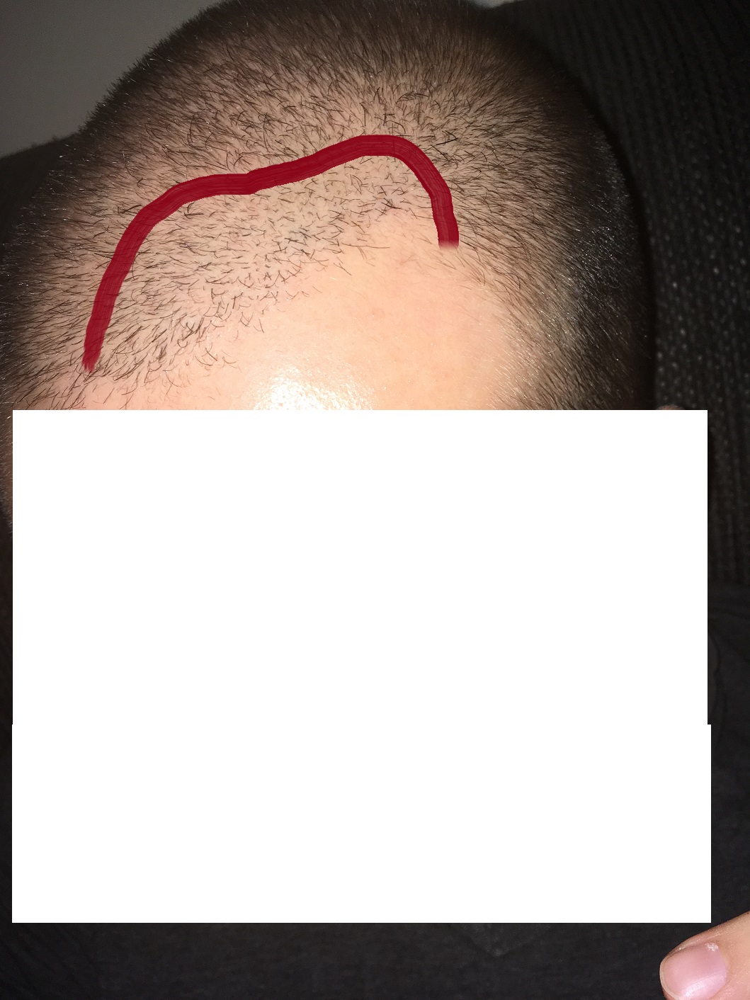 /foren/transplant/index.php/fa/40498/0/