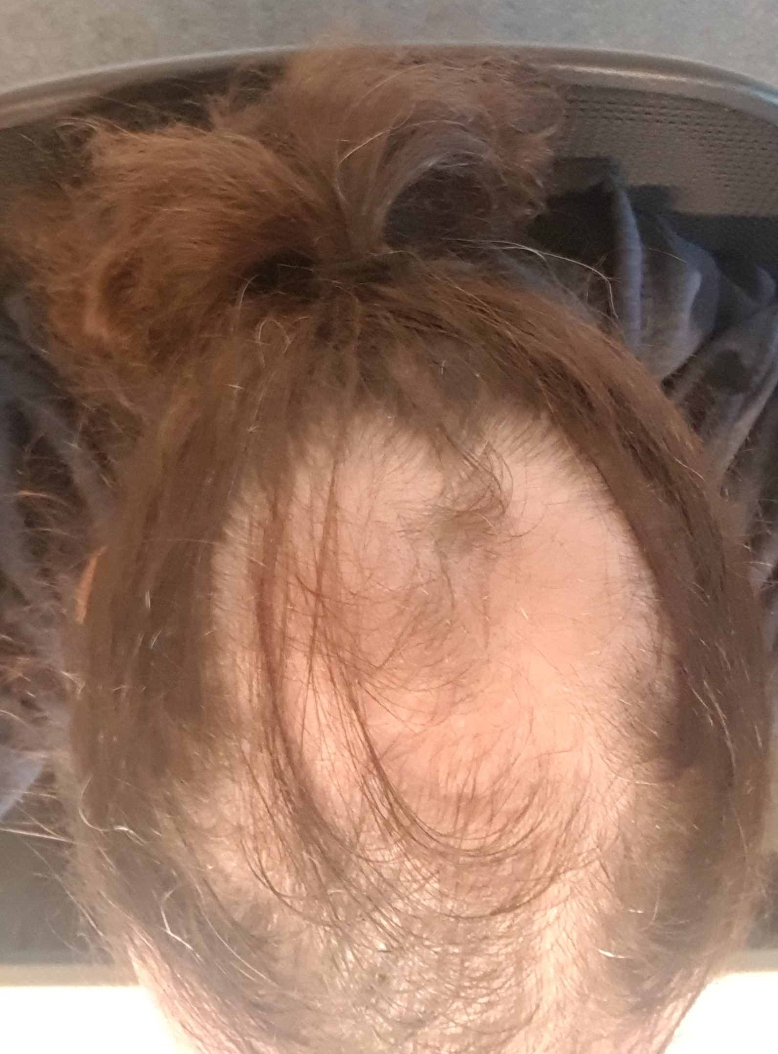 /foren/transplant/index.php/fa/40507/0/