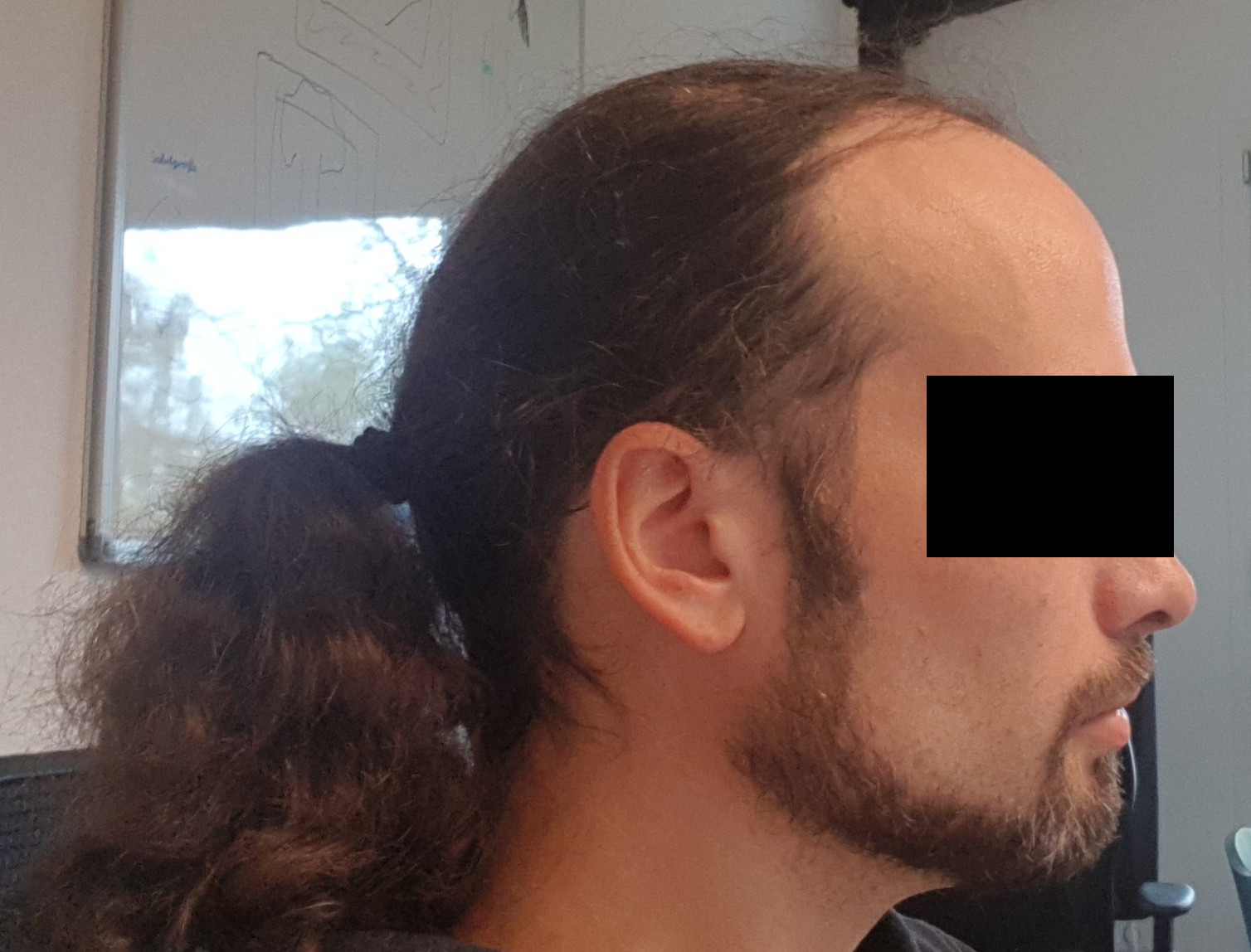 /foren/transplant/index.php/fa/40508/0/