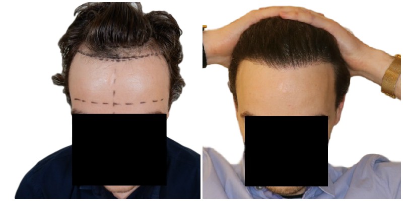 /foren/transplant/index.php/fa/40611/0/