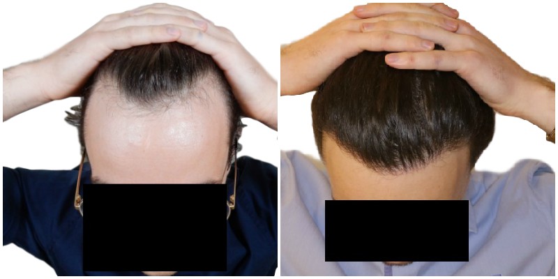 /foren/transplant/index.php/fa/40612/0/