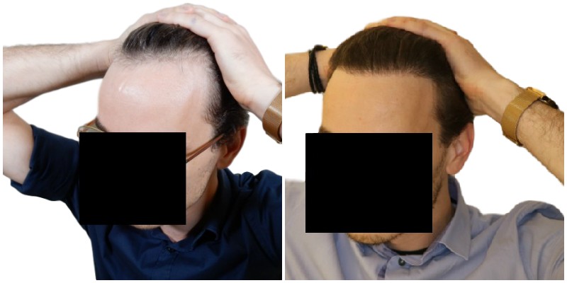 /foren/transplant/index.php/fa/40613/0/