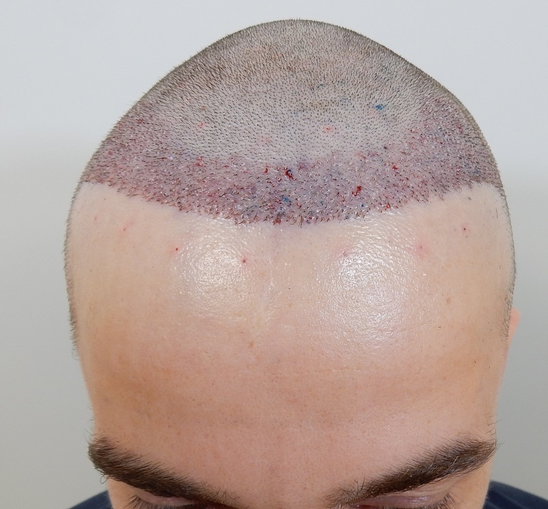 /foren/transplant/index.php/fa/40620/0/