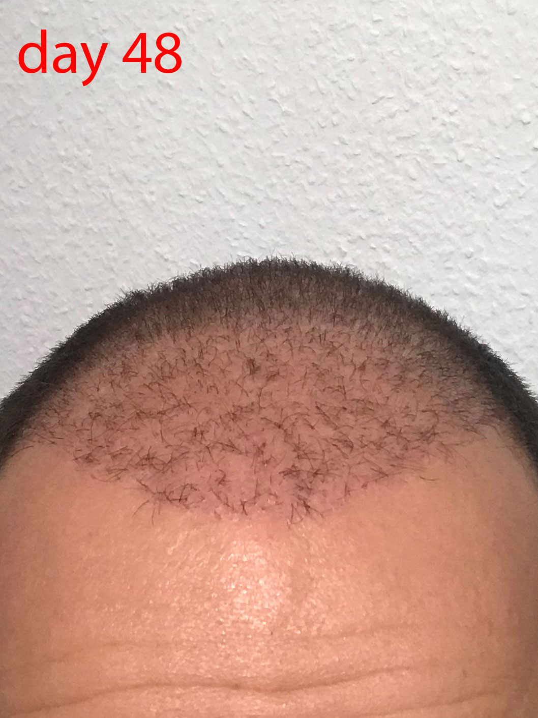 /foren/transplant/index.php/fa/40692/0/